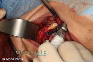 md_clinic_11_Implanturi 24 25