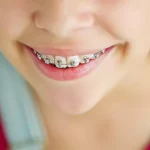 3a93534369d44dc9cb790ff3ae0ad9ef